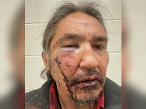 Chief Allan Adam of the Athabasca Chipewyan First Nation is accusing RCMP of beating him outside the Boomtown Casino in Fort McMurray in March.
