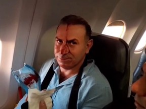 An image grab from a video released by state-run Iran Press news agency on July 24, 2020, reportedly shows a passenger with blood dripping on his face, on an Iranian passenger plane after it was intercepted by a US F-15 while flying over Syria.