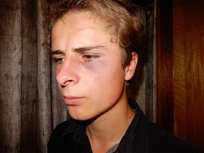 A photo taken of Jeremia Leussink after a July 31 incident with Alberta sheriffs that led to his arrest. He and his brother, Dominic Leussink, are facing charges after the incident. Their family has set up a GoFundMe.