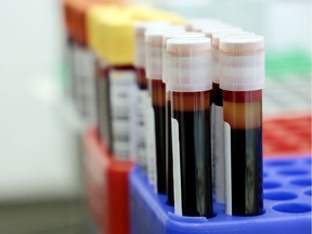 Some Canadian senators are beefing about their benefits plan. Blood samples are pictured above.