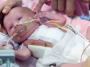 Three-week-old Vanellope Wilkins was borne with a rare condition where her heart growing outside of her body. (YouTube/Business Insider UK)