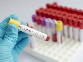 In this stock photo, a lab technician holds a blood sample that tested positive for syphilis.