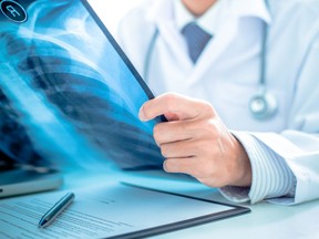 In this stock photo, a radiologist examines a chest X-ray.