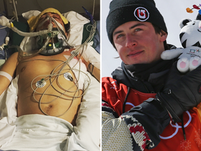 Mark McMorris nearly died in a backcountry accident last year, and now he's a medallist at the Olympics.