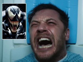 Tom Hardy stars in the upcoming Marvel film, Venom. (Marvel/Sony Pictures Entertainment)