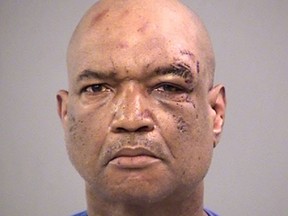 Gary Madison of Indianapolis is seen in an undated booking photo released Sunday, April 8, 2018, by the Marion County Jail. Madison faces three preliminary charges of battery by means of a deadly weapon.  (Marion County Jail via AP)