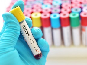 In this stock photo, a lab technician holds a blood sample positive with the rabies virus.