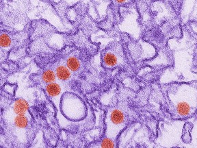 FILE - This 2016 digitally-colorized electron microscope image made available by the Centers for Disease Control and Prevention shows the Zika virus, in red, about 40 nanometers in diameter. A study released on Wednesday, April 11, 2018 suggests although signs of Zika infection can be seen in men's semen for nearly a year, the risk of sexual transmission appears to fade in just one month.