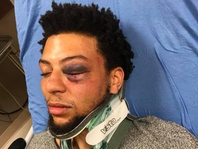 Jalen Bell suffered injuries to his face, abdomen and back after being allegedly beaten by a group of white security guards at a Dallas, Texas strip club. (Facebook)