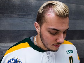 Kaleb Dahlgren, one of the survivors of the deadly Humboldt Broncos bus crash stands for a portrait in his home in Saskatoon, Sask., on May, 7, 2018