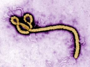 FILE - In this undated colorized transmission electron micrograph file image made available by the CDC shows an Ebola virus virion.  Congo's Ebola outbreak has spread to a city, the capital of the northwestern Equateur province, a worrying shift as the risk of infection is more easily passed on in densely populated urban areas.