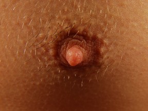 Male Nipple
