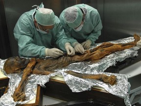 In this November 2010 photo provided by the South Tyrol Museum of Archaeology, researchers examine the body of a frozen hunter known as Oetzi the Iceman to sample his stomach contents in Bolzano, Italy.
