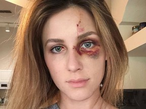 Melissa Gentz took to social media to show the beating her boyfriend allegedly gave to her.