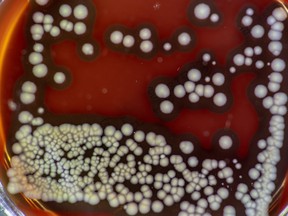 A petri dish with bacteria is pictured in this file photo. (Getty Images)