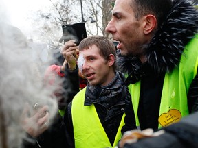A wounded protester attends the yellow vests demonstration Saturday, Feb. 2, 2019 in Paris.