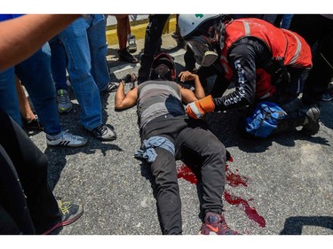 An opposition demonstrator injured when Venezuelan security forces used an armoured vehicle to ram demonstrators during clashes in the surroundings of La Carlota military base in Caracas, is being assisted on April 30, 2019.