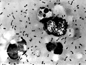 This Centers For Disease Control (CDC) file image obtained on January 15, 2003, shows the bubonic plague bacteria taken from a patient.  (Hand out/AFP/Getty Images)