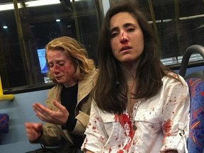 Melania Geymonat, right, and girlfriend Chris are bloodied after being attacked on a London bus when they refused to kiss for a mob of men.