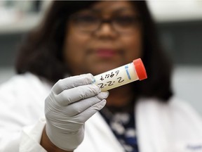 Rupasri Mandal, facility manager for the Metabolomics Innovation Centre at the University of Alberta, holds a vial of milk used in the university's milk encyclopedia in Edmonton on Friday, July 5, 2019.