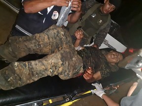 Handout picture released by Guatemala's Defence Ministry showing a wounded soldier being assisted after an ambush by alleged drug traffickers on September 4, 2019. (HO / Guatemala's Defence Ministry / AFP)
