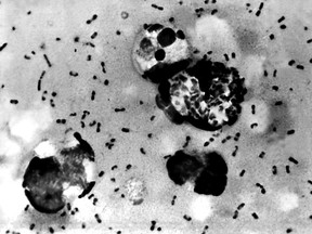This Centers For Disease Control (CDC) file image obtained on Jan. 15, 2003, shows the bubonic plague bacteria taken from a patient.  (AFP PHOTO/CDC)