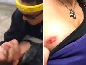 Mixed Martial Artist Tara LaRosa took down an anti-Trump protester in Oregon this past weekend. During the scuffle, LaRosa claimed the protester bit her chest. (Twitter)