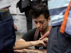 Chilean student Gustavo Gatica waits for first aid carere after being shot in the face by Chilean police with rubber bullets during a protests in Santiago, Chile November 8, 2019.