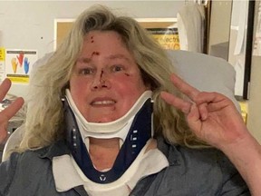 Kirkland resident Karen Cliffe sustained facial lacerations and a mild concussion after ice smashed her windshield while she was driving on Highway 40.