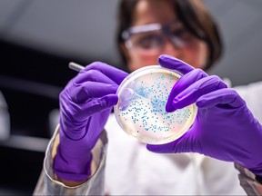 woman researcher performing examination of bacterial culture plate