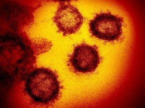 This handout illustration image obtained Feb. 27, 2020, courtesy of the National Institutes of Health shows a transmission electron microscopic image that shows SARS-CoV-2, also known as 2019-nCoV, the virus that causes COVID-19.