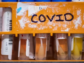 Specimens to be tested for COVID-19 are seen at LifeLabs after being logged upon receipt at the company's lab, in Surrey, B.C., on Thursday, March 26, 2020. LifeLabs is Canada's largest private provider of diagnostic testing for health care.