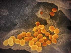 This undated electron microscope image made available by the U.S. National Institutes of Health in February 2020 shows the Novel Coronavirus SARS-CoV-2, orange, emerging from the surface of cells, gray, cultured in the lab.