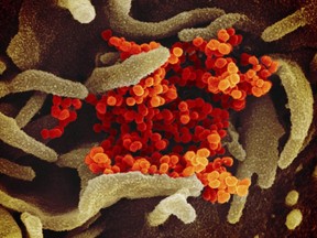 This undated electron microscope image made available by the U.S. National Institutes of Health in February 2020 shows the Novel Coronavirus SARS-CoV-2, orange, emerging from the surface of cells, green, cultured in the lab. Also known as 2019-nCoV, the virus that causes COVID-19.
