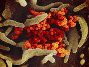 This undated electron microscope image made available by the U.S. National Institutes of Health in February 2020 shows the novel coronavirus SARS-CoV-2, orange, emerging from the surface of cells, green, cultured in the lab. Also known as 2019-nCoV, the virus that causes COVID-19.