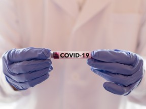 COVID-19 named by WHO for Novel coronavirus NCP concept. Doctor or lab technician holding blood sample with novel (new) coronavirus N.C.P. in Wuhan, Hubei Province, China, medical and healthcare