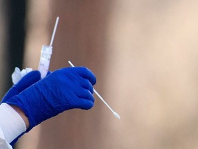 A medical worker holds a swab while preparing to proceed drive-through COVID-19 tests outside the Santa Maria della Pieta' hospital in Rome on April 3, 2020. (Photo by TIZIANA FABI/AFP via Getty Images)