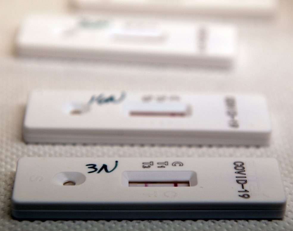 Health Canada approves serological test to detect COVID19 antibodies Ottawa Sun