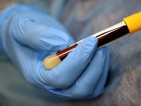 Residents have their blood drawn by registered nurse Barbara Davis for an antibody test for the coronavirus, also called a serology test, June 16, 2020 in Washington, D.C.