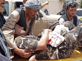 A wounded personnel of National Directorate of Security (NDS) is brought on a stretcher to a hospital after a car bomb exploded in the city of Aybak, in Samangan province on July 13, 2020.