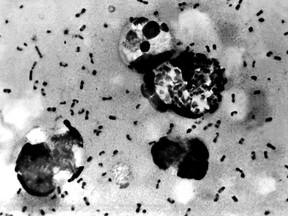 This Centers For Disease Control (CDC) file image obtained on January 15, 2003, shows the bubonic plague bacteria taken from a patient.