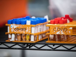 Specimens to be tested for COVID-19 are seen at LifeLabs after being logged upon receipt at the company's lab, in Surrey, B.C., on Thursday, March 26, 2020.