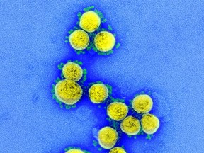 This undated handout image obtained August 11, 2020, courtesy of the National Institute of Allergy and Infectious Diseases(NIH/NIAID), shows a ransmission electron micrograph of SARS-CoV-2 virus particles, isolated from a patient, captured and colour-enhanced at the NIAID Integrated Research Facility (IRF) in Fort Detrick, Md.