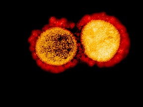 This undated handout image obtained August 11, 2020, courtesy of the National Institute of Allergy and Infectious Diseases(NIH/NIAID), shows a transmission electron micrograph of SARS-CoV-2 virus particles, isolated from a patient,captured and color-enhanced at the NIAID Integrated Research Facility (IRF) in Fort Detrick, Maryland.
