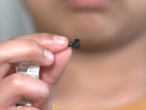 Sameer Anwar of New Zealand stuck a Lego piece up his nose. It fell out two years later.