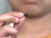 Sameer Anwar of New Zealand stuck a Lego piece up his nose. It fell out two years later.