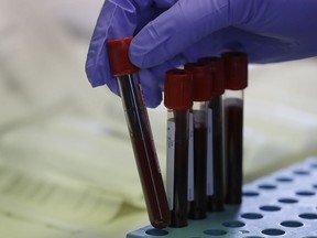 Blood samples from volunteers are handled in the laboratory at Imperial College in London, Thursday, July 30, 2020.