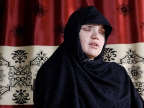 Khatera, 33, an Afghan police woman who was blinded after a gunmen attack in Ghazni province, speaks during an interview in Kabul, Afghanistan Oct. 12, 2020.