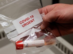 A staff member holds a sample for a rapid COVID-19 antigenic test made by Swiss drugmaker Roche, at the University Hospital (CHUV) in Lausanne, Switzerland, November 13, 2020.