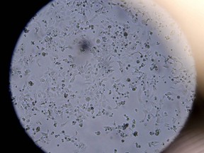 Cells containing the novel coronavirus are seen through a microscope at the Stabilitech laboratory in Burgess Hill, England, May 15, 2020.